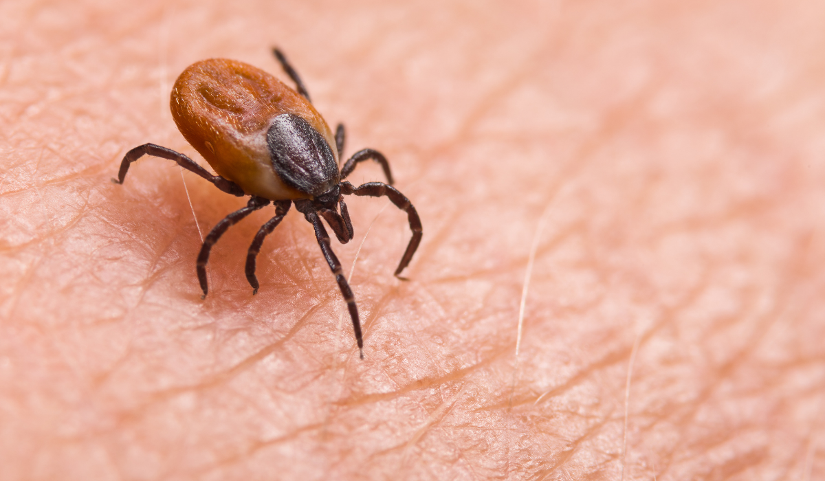 Engorged tick with brown body and black legs crawling on human skin