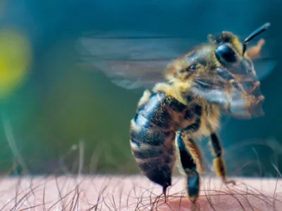 Bee with stinger embedded in human forearm skin, wings blurred from movement